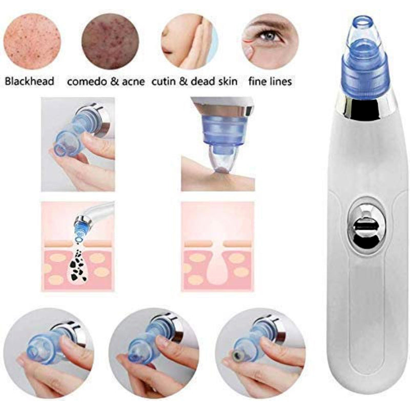 4 in 1 Vacuum Pore Cleaning Device